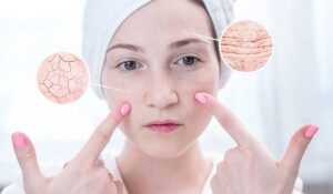 barierahydrolipidowa_wp