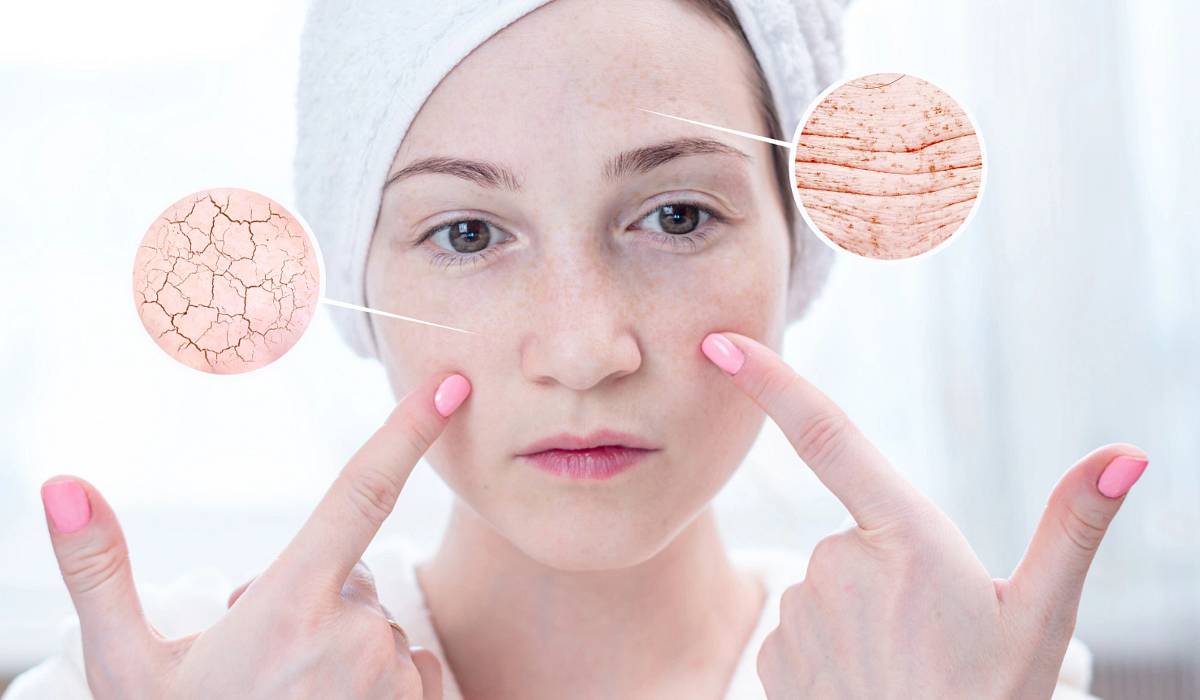 barierahydrolipidowa_wp